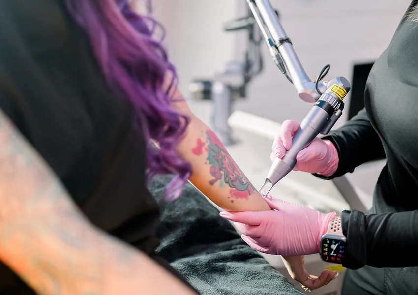 a person getting a tattoo on their arm