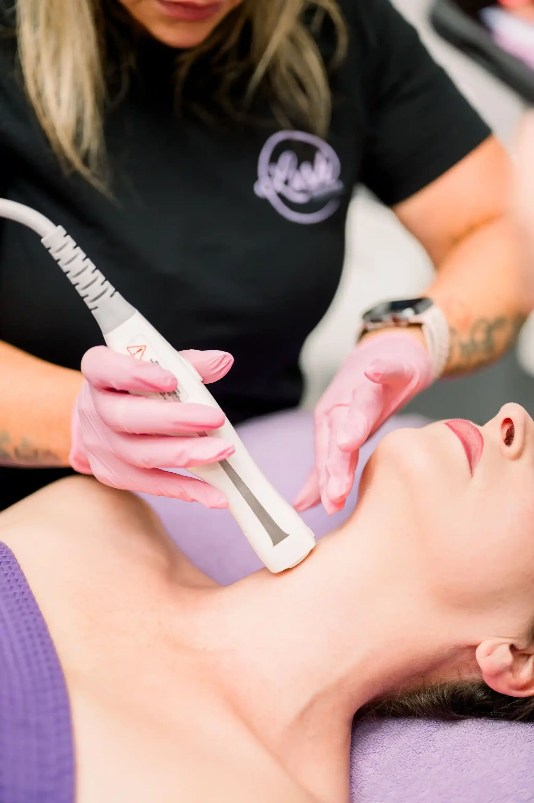 Microneedling-F-in Tuscaloosa, AL