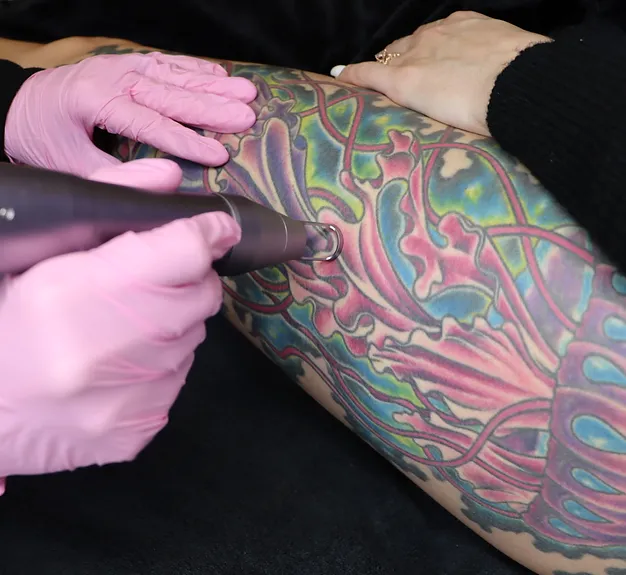 a person getting a tattoo