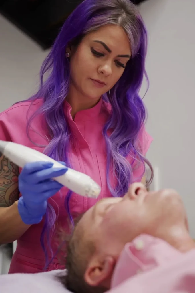 Microneedling Treatment in Tuscaloosa, AL | Lush Medspa