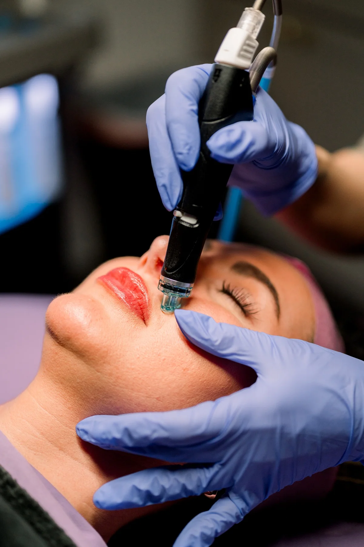 Hydrafacial at Lush MedSpa Tuscaloosa AL