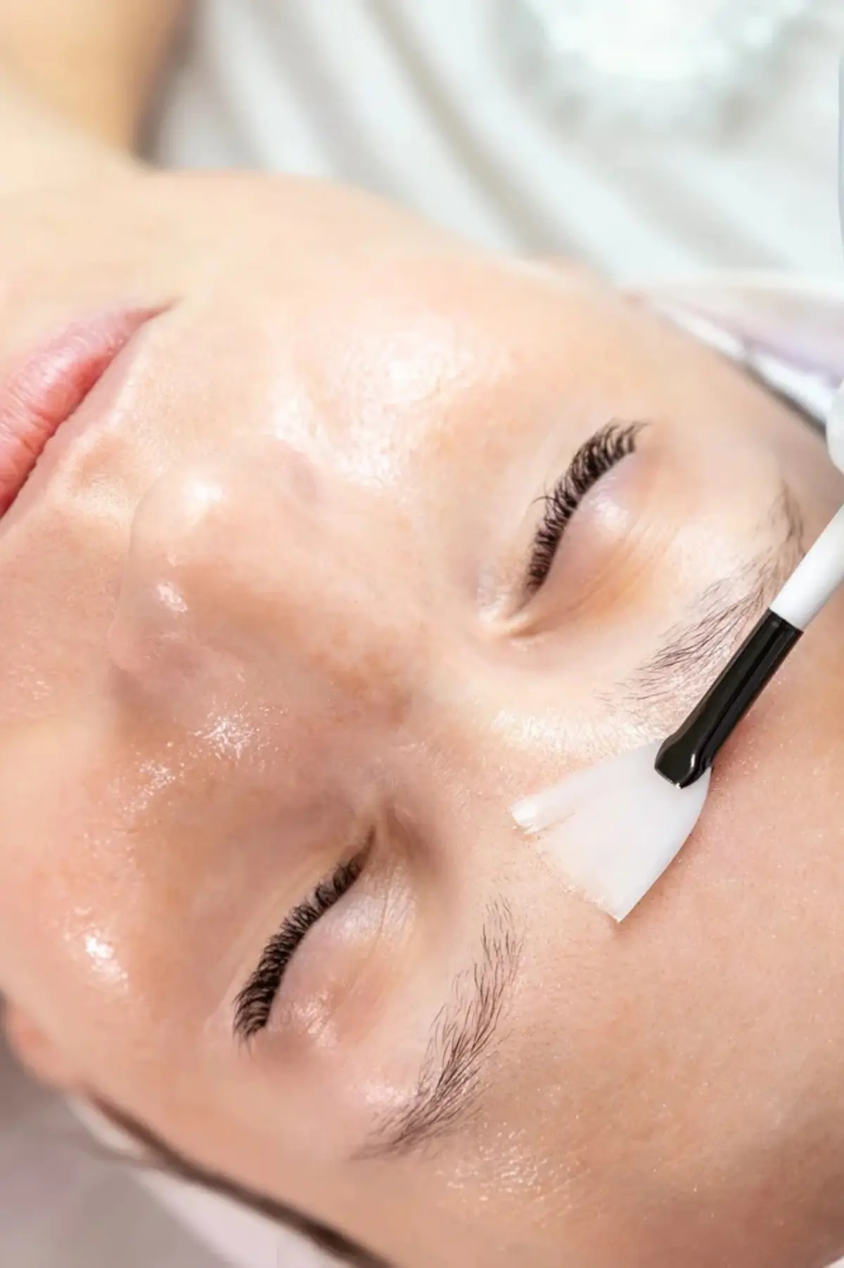 Chemical Peel at Lush MedSpa Tuscaloosa
