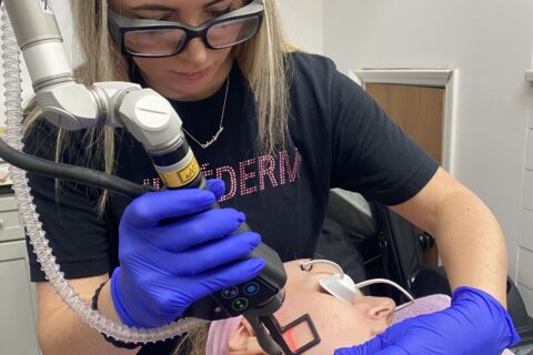 CO2 Laser Treatments