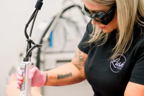 Laser Vein Treatments
