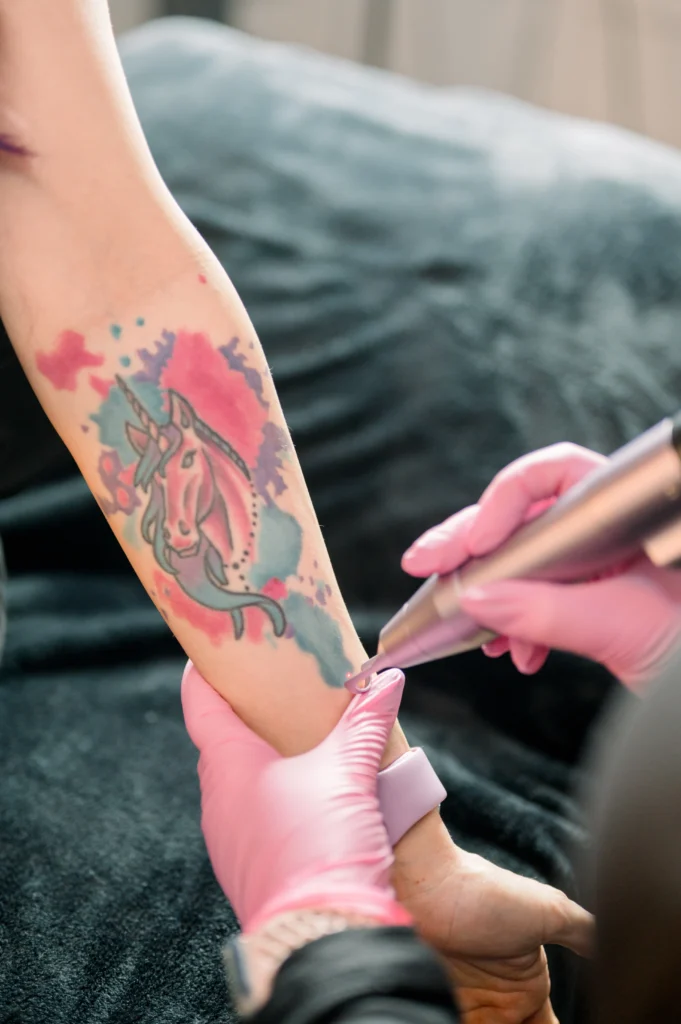 Laser tattoo Removal at LushMedSpa Tuscaloosa AL