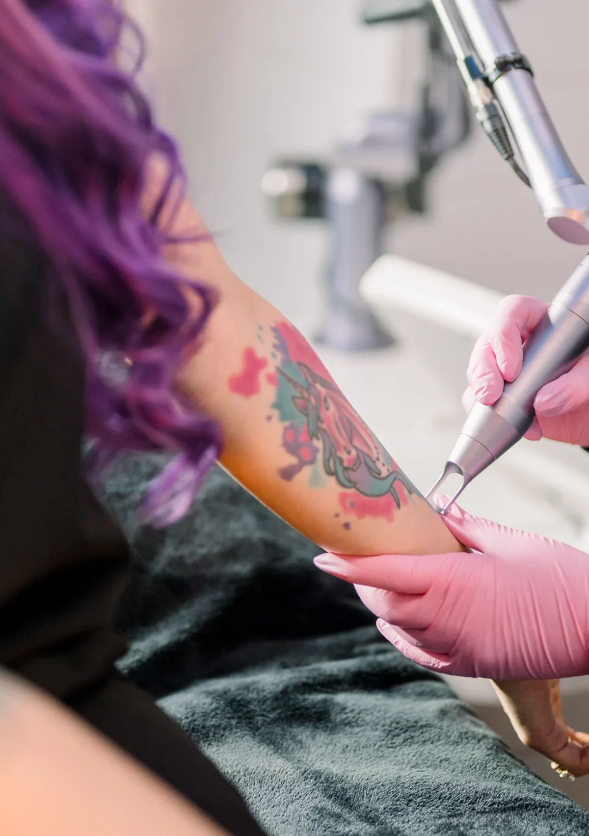 Laser Tattoo-removal at Lush MeSpa Tuscaloosa