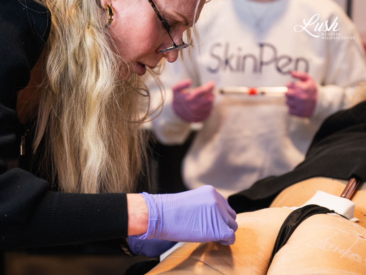 Radiesse Butt Lift at Lush MedSpa Tuscaloosa