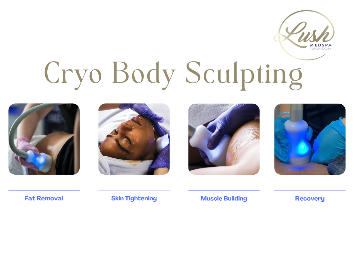 Cryo Body Sculpting in Tuscaloosa, AL