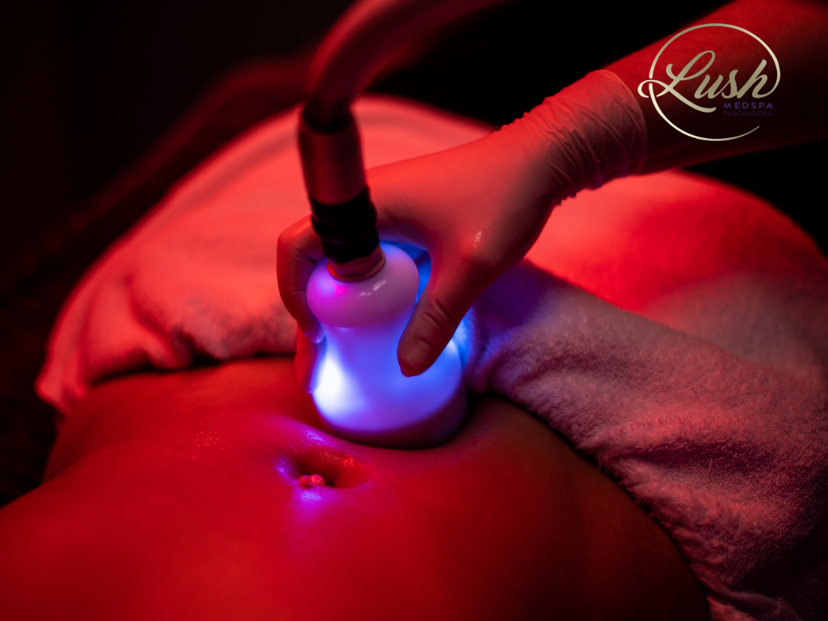 Cryo Body Sculpting at Lush MedSpa