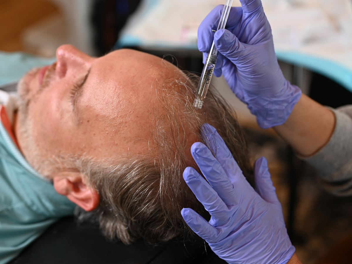 DE|RIVE Hair Restoration in Tuscaloosa AL