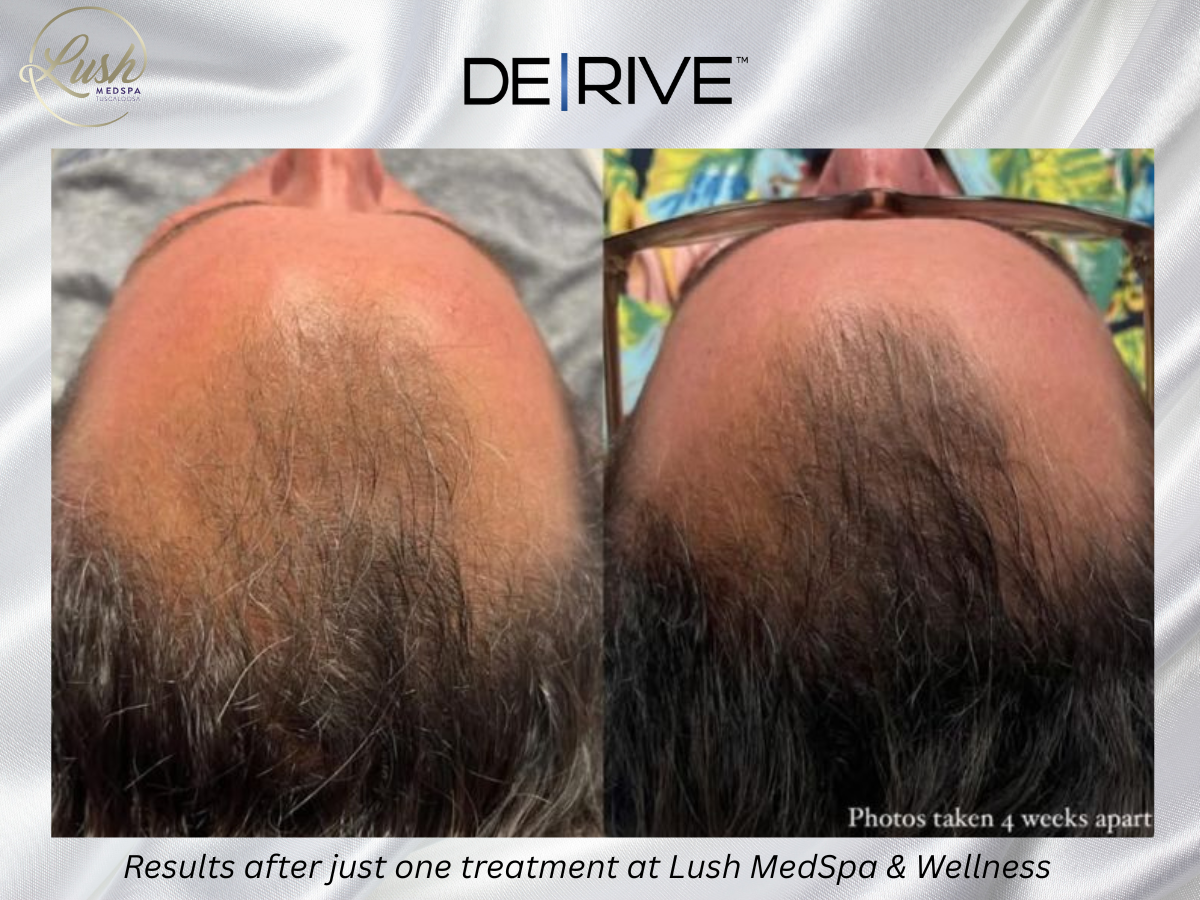 DE|RIVE Hair Restoration in Tuscaloosa AL