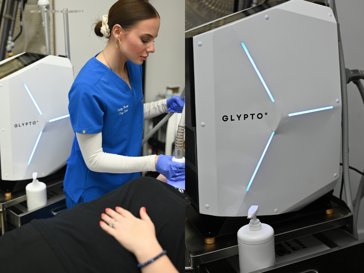 Glypto Cryo Body Sculpting In Tuscaloosa, AL