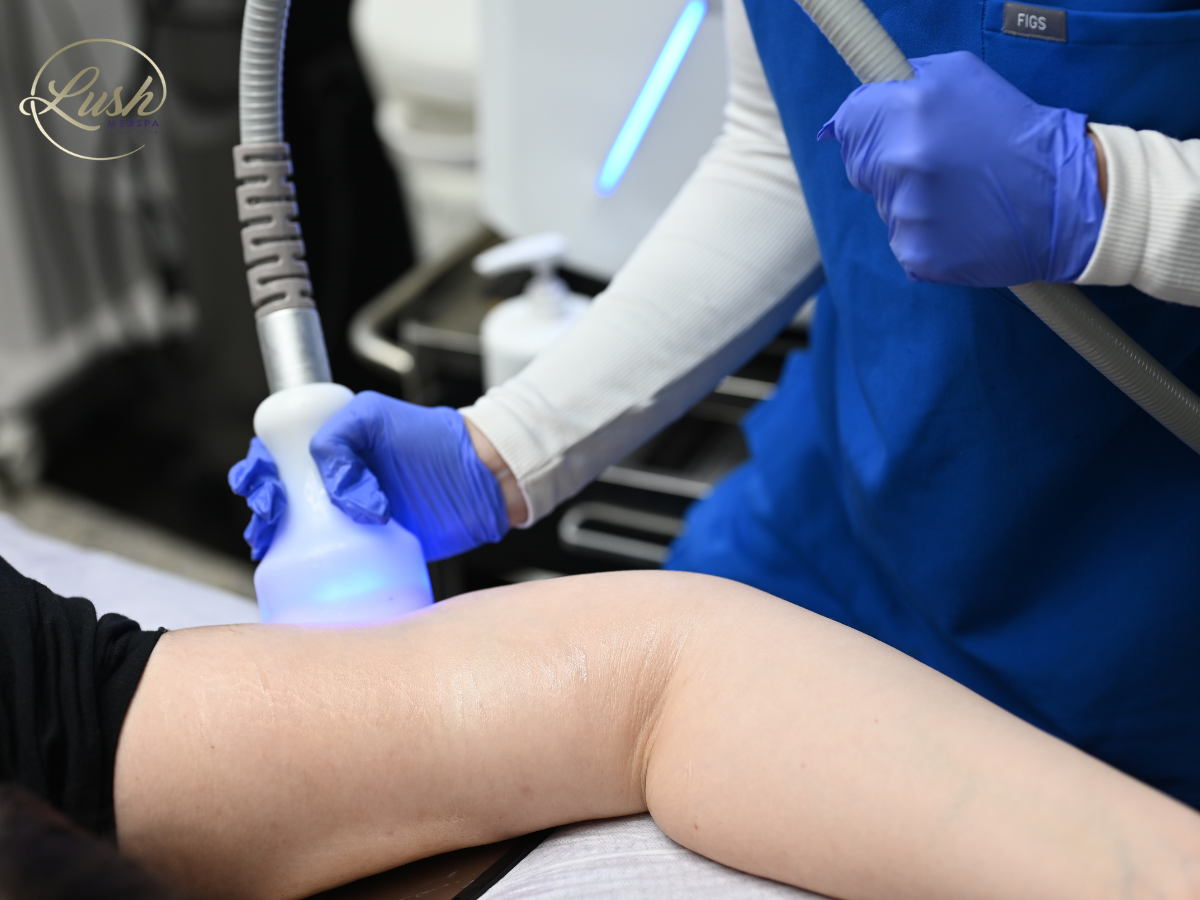 Glypto Cryo Body Sculpting at Lush MedSpa Tuscaloosa