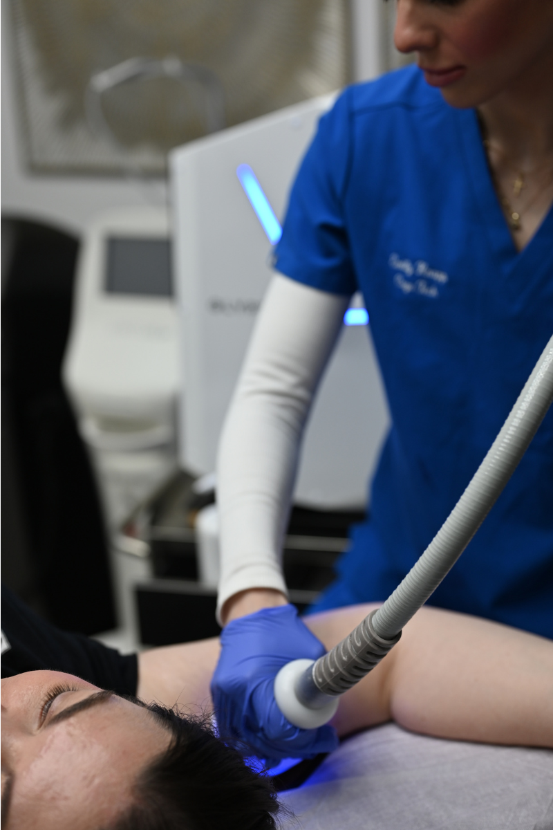 Glypto Cyro Body Sculpting at Lush MedSpa Tuscaloosa, AL