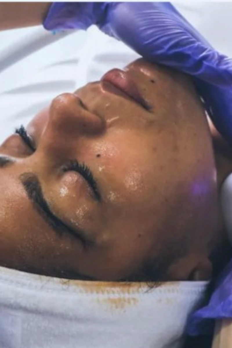 Glypto Cyro Body Sculpting in Tuscaloosa, AL