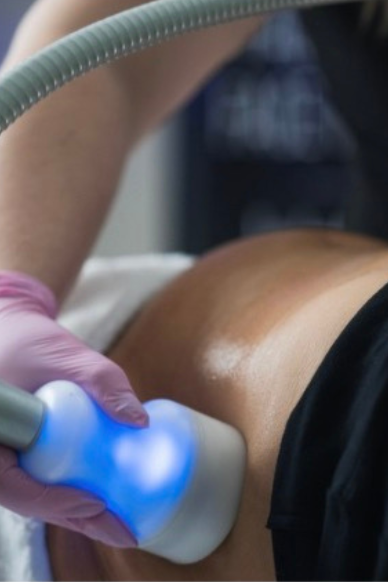 Glypto Cyro Body Sculpting in Tuscaloosa