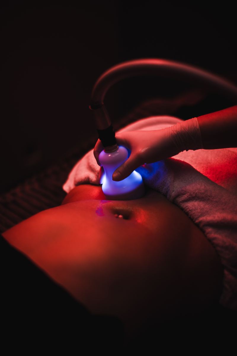 Glypto Cyro Body Sculpting in Tuscaloosa, AL