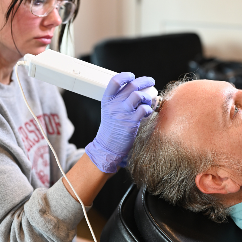 Needle Free Hair Restoration at Lush MedSpa Tuscaloosa