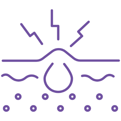 Acne & Acne Scarring Treatment with Ama Harmony Laser at Lush MedSpa Tuscaloosa, AL